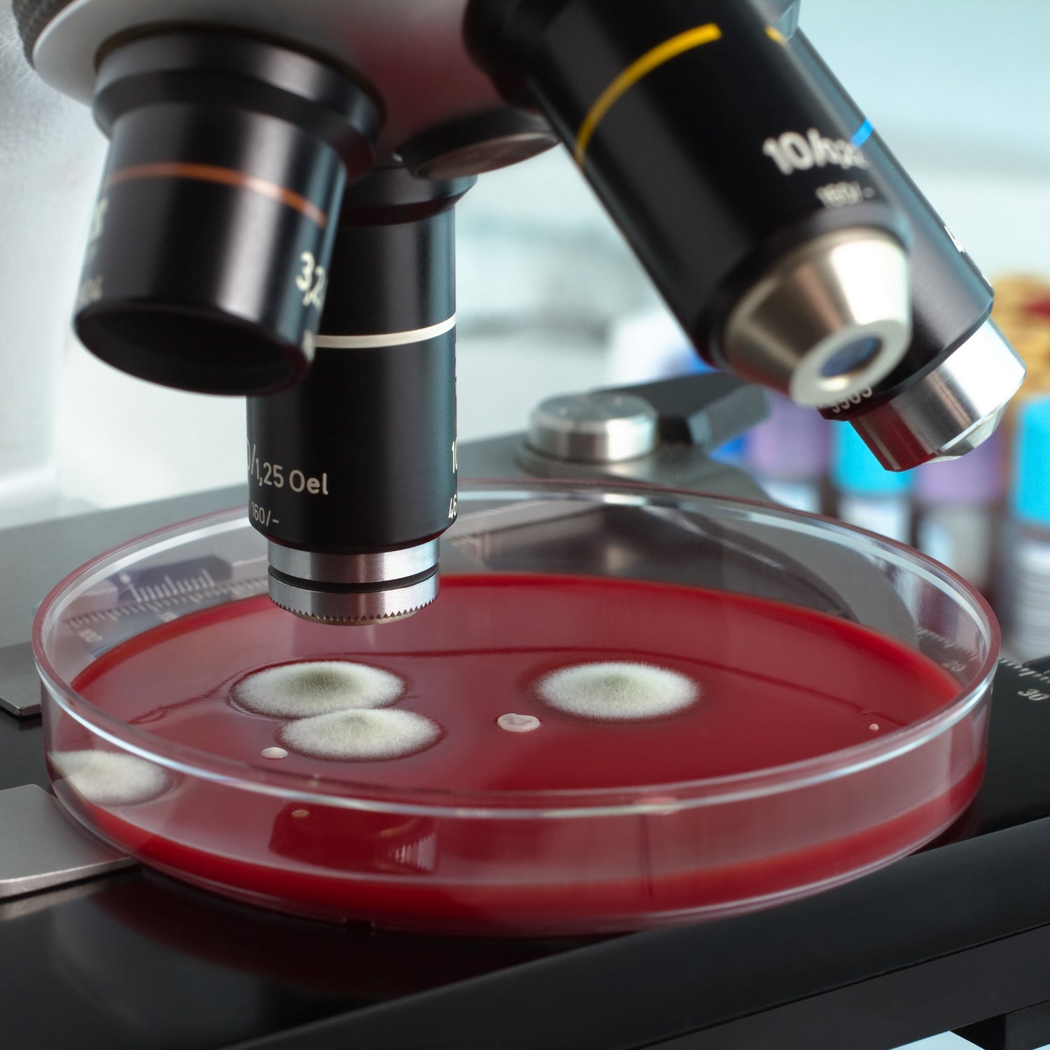 &lt;Round red blood agar plate with four white furry mould or yeast growths placed under the lens of a microscope for identification. Credit&gt; AdobeStock_109808595