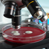 <Round red blood agar plate with four white furry mould or yeast growths placed under the lens of a microscope for identification. Credit> AdobeStock_109808595