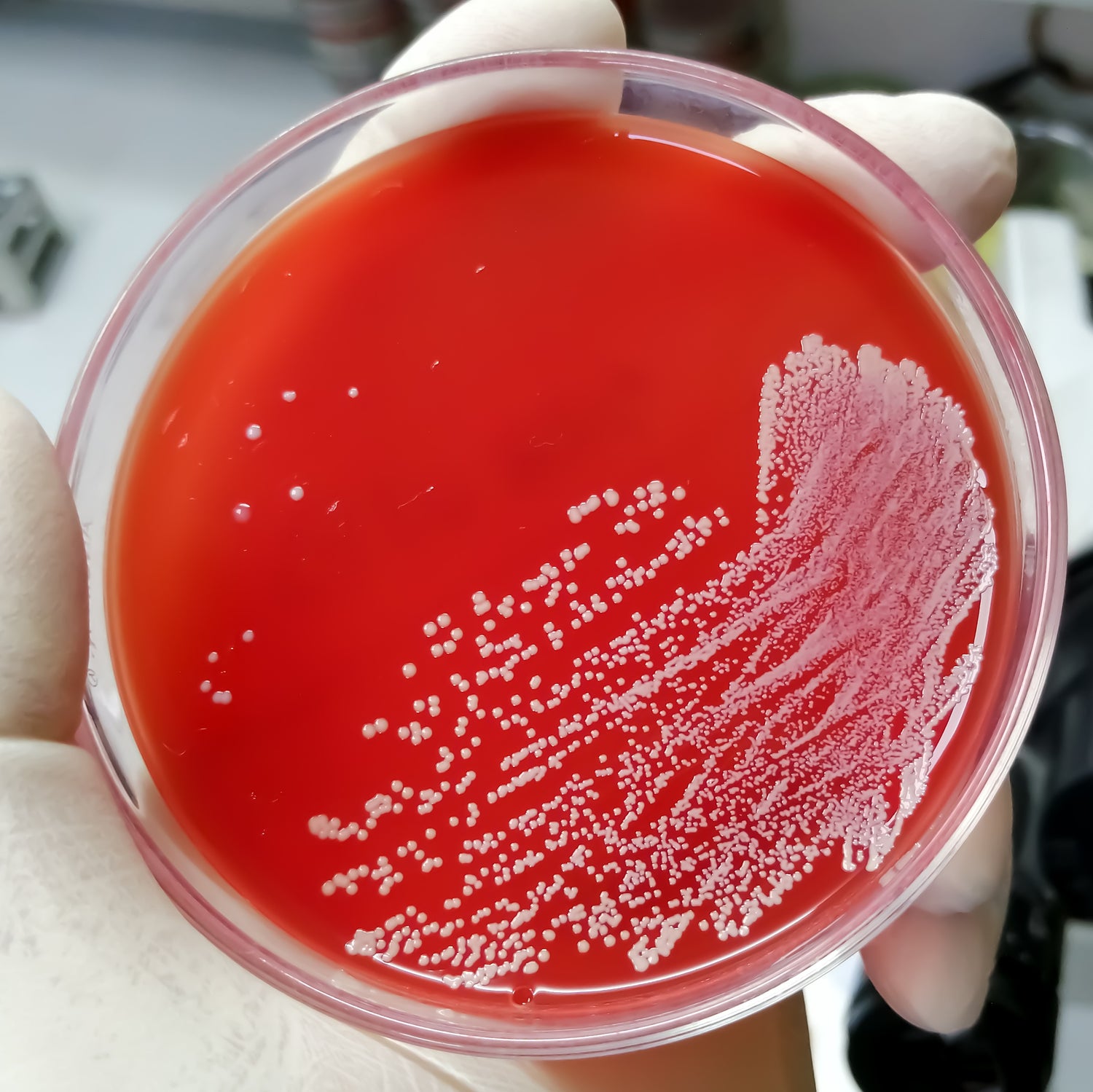 &lt;Hand of microbiologist in white glove holding a round red blood agar plate showing a white growth of microorganisms where the plate has been streaked with product. Credit&gt; AdobeStock_482355351