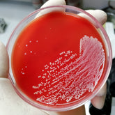 <White growth on round red blood agar plate where the plate has been streaked with product. Credit> AdobeStock_482355351