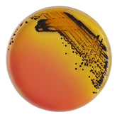 <Black salmonella colonies as spots on a round SS agar medium plate with yellow surround instead of orange away from where it has been streaked. Credit> 78475244
© Chansom Pantip
| Dreamstime.com