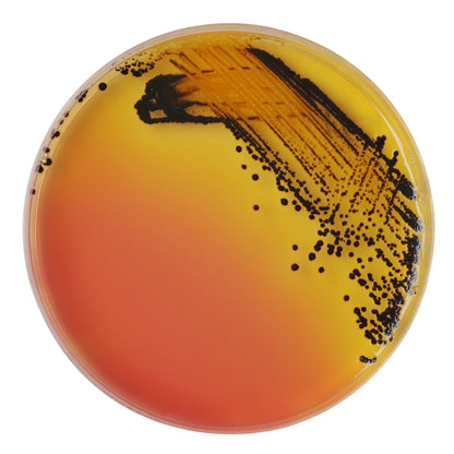 &lt;Black salmonella colonies as spots on a round SS agar medium plate with yellow surround instead of orange away from where it has been streaked. Credit&gt; 78475244
© Chansom Pantip
| Dreamstime.com