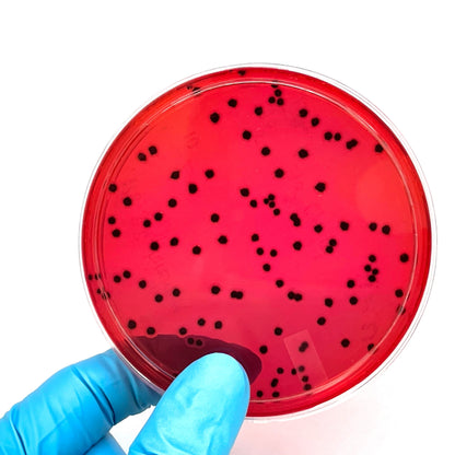 &lt;Hand in blue glove holding a round XLD agar plate showing Salmonella colonies as small, irregular spaced black spots on red media. Credit&gt; 2269181847 by Pattar.w092 @ Shutterstock